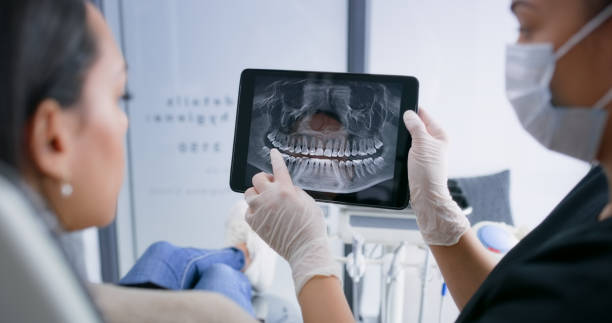 Licensed Wisdom Tooth Removal service in North Olmsted, OH - Smile Center Dentistry